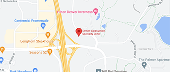 Map of our Denver, CO location