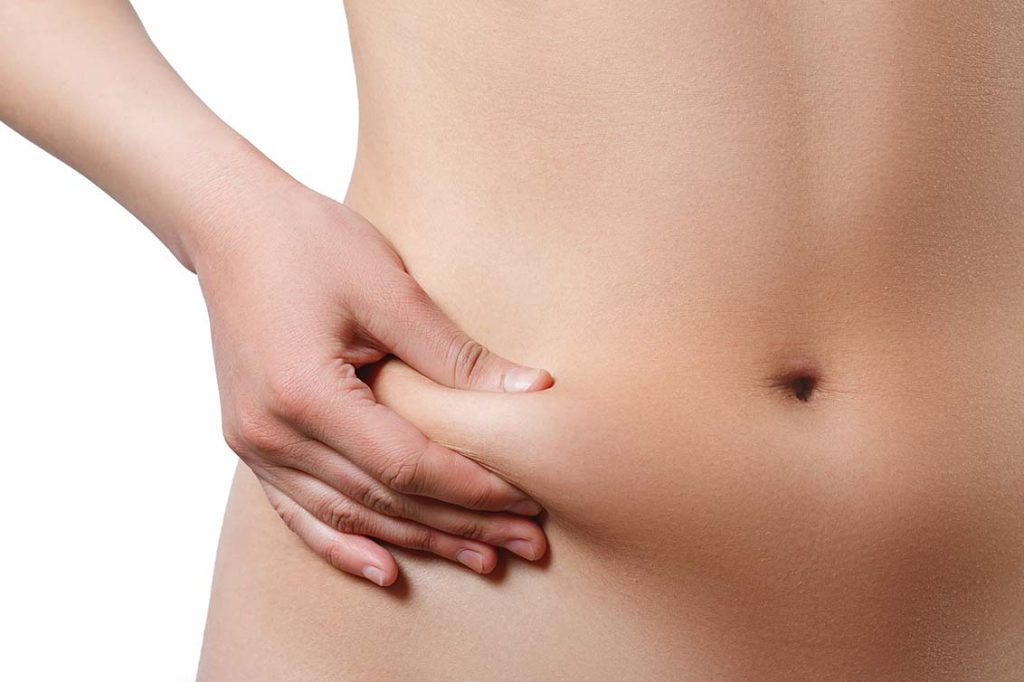 Liposuction vs Tummy Tuck