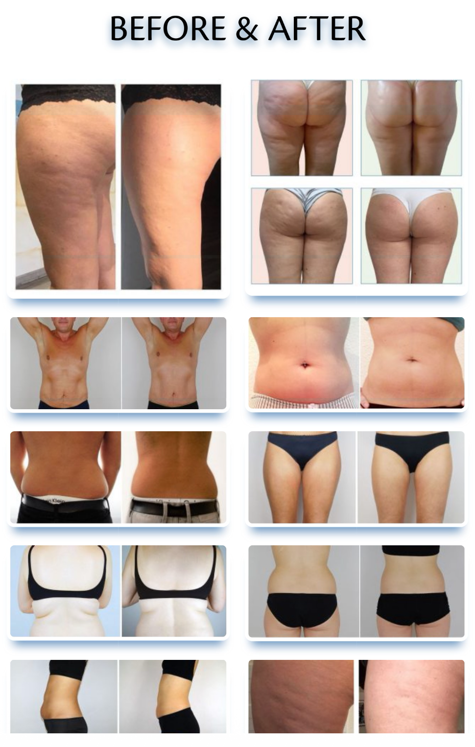 tirzepatide in carmel GLP-1 Weight Loss Plan - Carmel, IN tirzepatide in carmel GLP-1 Weight Loss Plan - Carmel, IN